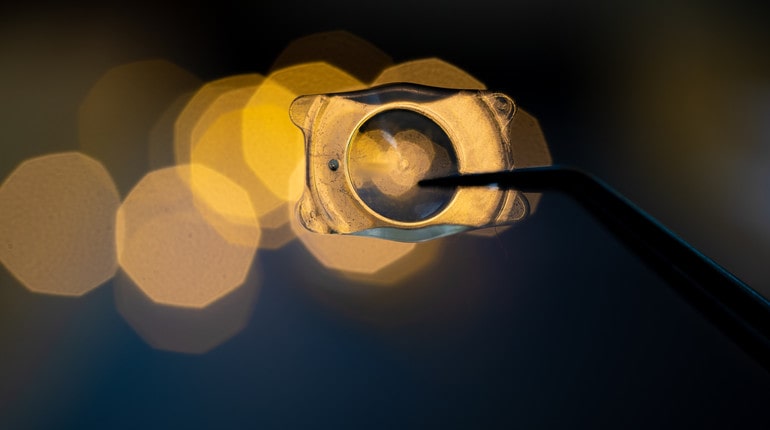 implantable lenses laser eye surgeries